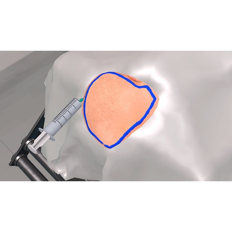 Изображение товара Лицензия ModumLab на хирургический тренажер для декомпрессионной краниотомии